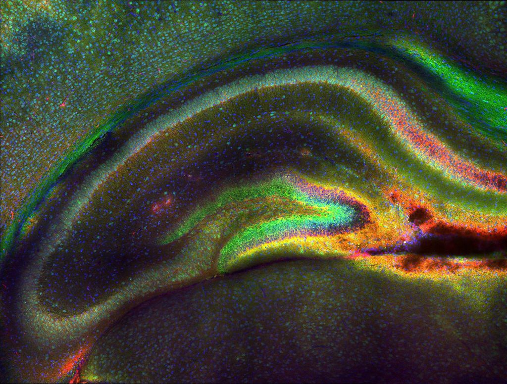 Neurons